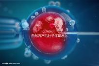 自然流產(chǎn)后肚子疼是怎么回事