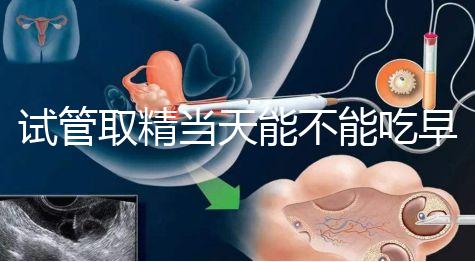 試管取精當(dāng)天能不能吃早餐喝水的答案來(lái)咯咯，好不好一看就知道了？