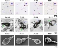 試管促排卵不同方案都適合哪些人？如何監測排卵？