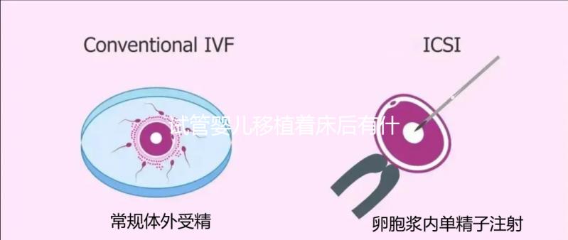 試管嬰兒移植著床后有什么反應(試管嬰兒移植著床后有什么反應嗎)