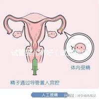 試管嬰兒哪好(試管嬰兒權威醫院哪家最好)