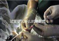 試管嬰兒什么時候取精(試管嬰兒什么時候取精是男孩的)