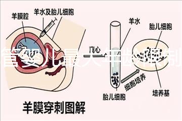 試管嬰兒最大年齡限制（試管嬰兒最大年齡限制是多少）