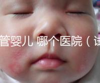 試管嬰兒 哪個醫院(試管嬰兒哪個醫院做的最好)