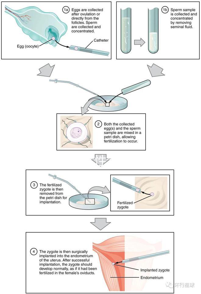 貴陽單身女性禁止凍卵？持“三證”已婚女性就能凍卵