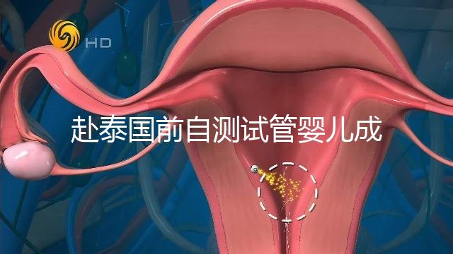 赴泰國前自測試管嬰兒成功率，這些方法值得收藏