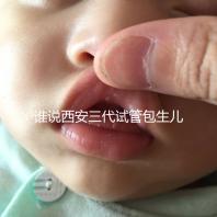 誰(shuí)說(shuō)西安三代試管包生兒子多少錢(qián)看醫(yī)院，能不能做還兩說(shuō)