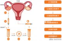這取決于天津供精試管的成功率最新的醫院名單供您參考