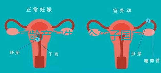 高齡產(chǎn)婦生八個孩子國家有補助？有沒有違法才是關鍵