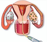 馬來西亞 試管嬰兒(馬來西亞試管嬰兒和泰國比較哪個更好)