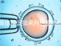 黃體期促排來月經(jīng)別擔(dān)心!過來人經(jīng)驗(yàn)告訴你怎么辦