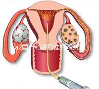 a2國產(chǎn)和進(jìn)口誰好不糾結(jié),看配方、口感、價格對比再選