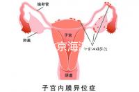 2024年北京海淀區(qū)新生兒醫(yī)療保險(xiǎn)處理策略,照片要求不要出錯(cuò)