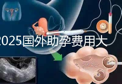 2025國外助孕費用大公開：單身人士費用對比與機構推薦