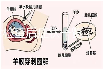 tct檢查后癥狀一覽，專家提醒做好處理措施是關鍵